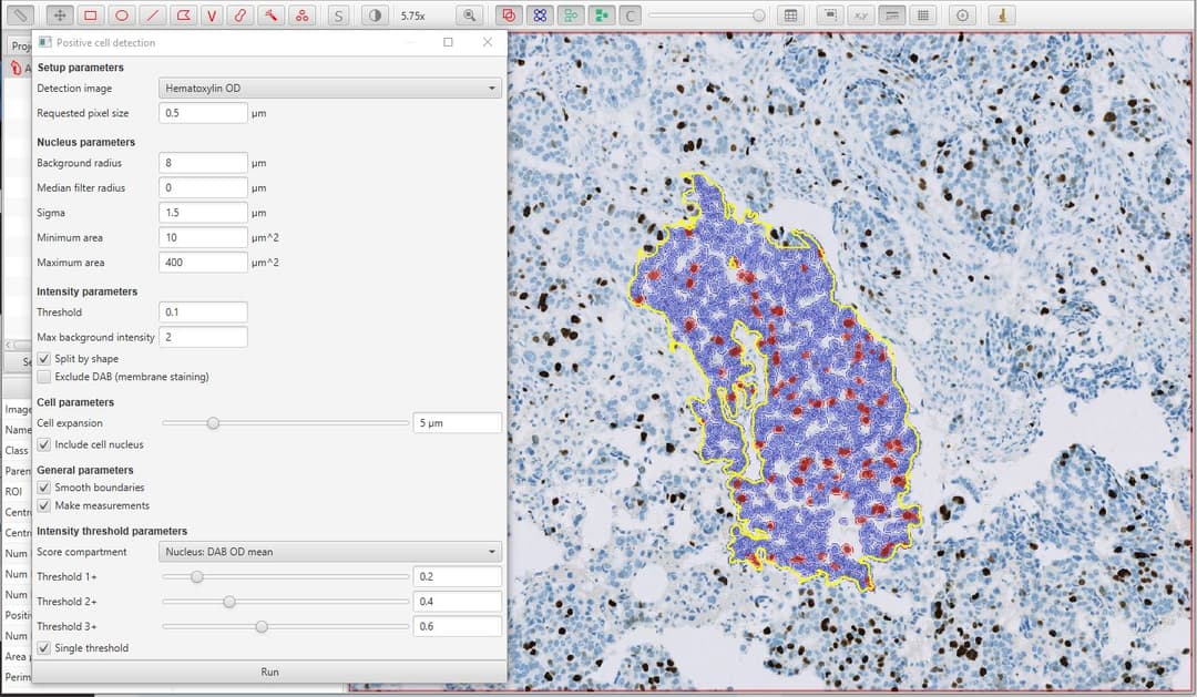 Positive cell detection in QuPath