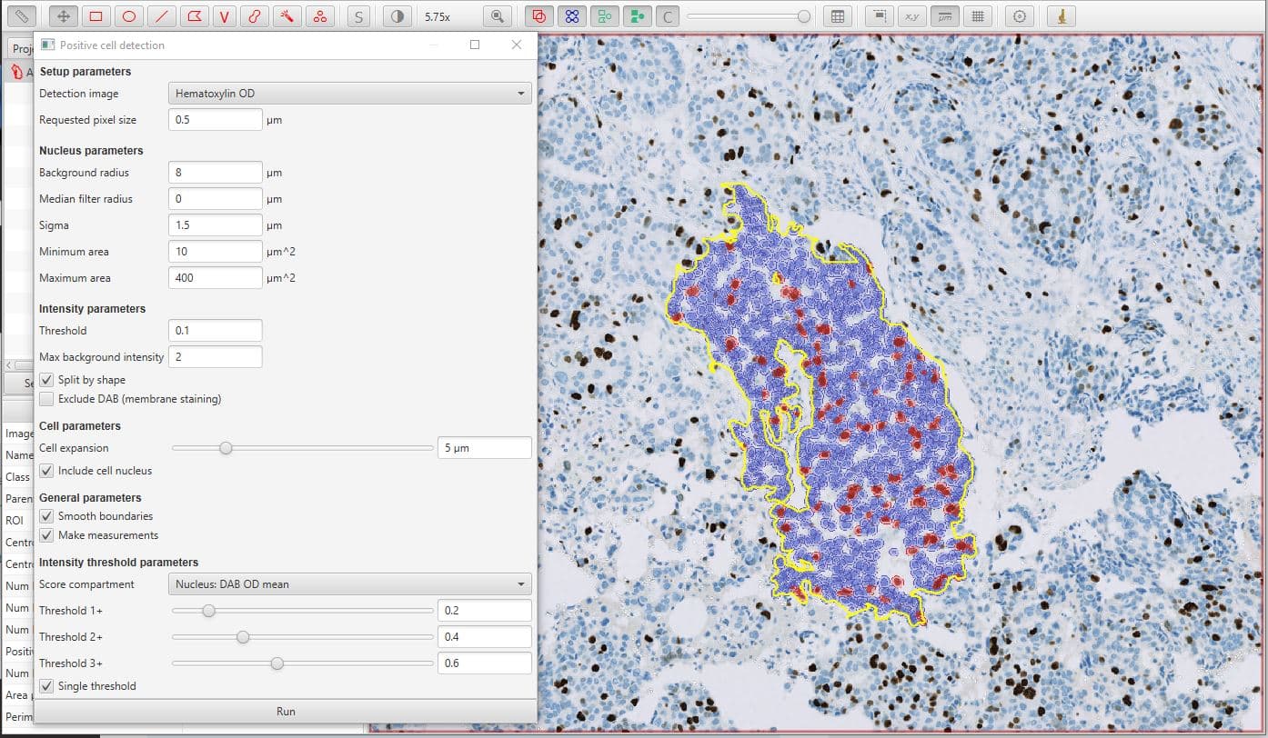 What Are Easy-to-Use AI Tools for Cancer Research?
